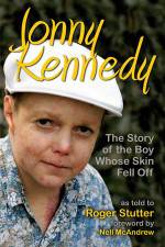 Watch The Boy Whose Skin Fell Off M4ufreemovies