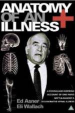 Watch Anatomy of an Illness M4ufreemovies