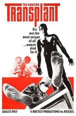 Watch The Amazing Transplant M4ufreemovies