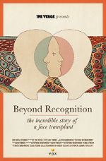 Watch Beyond Recognition: The Incredible Story of a Face Transplant M4ufreemovies