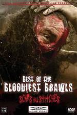 Watch TNA Wrestling: Best of the Bloodiest Brawls - Scars and Stitches M4ufreemovies