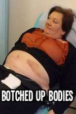 Watch Botched Up Bodies M4ufreemovies