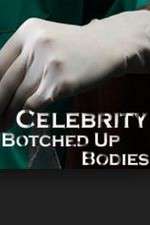 Watch Celebrity Botched Up Bodies M4ufreemovies